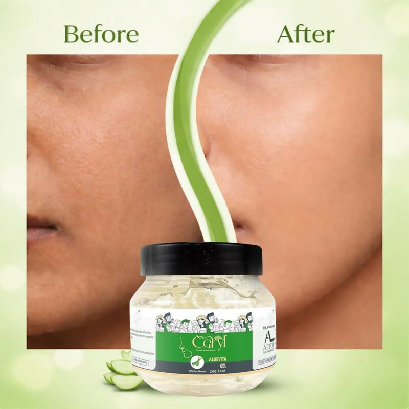 Caryl Aloe Vera Gel 250g for Face, Hair Care|Helps Reduce Acne,Sunburn & Dark Circles|Deep Hydration & Skin Brightening|Pure Aloe Vera,Tea Tree & Lemon Peel|Lightweight,Non-Greasy Gel For Men & Women