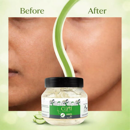 Caryl Aloe Vera Gel 250g for Face, Hair Care|Helps Reduce Acne,Sunburn & Dark Circles|Deep Hydration & Skin Brightening|Pure Aloe Vera,Tea Tree & Lemon Peel|Lightweight,Non-Greasy Gel For Men & Women